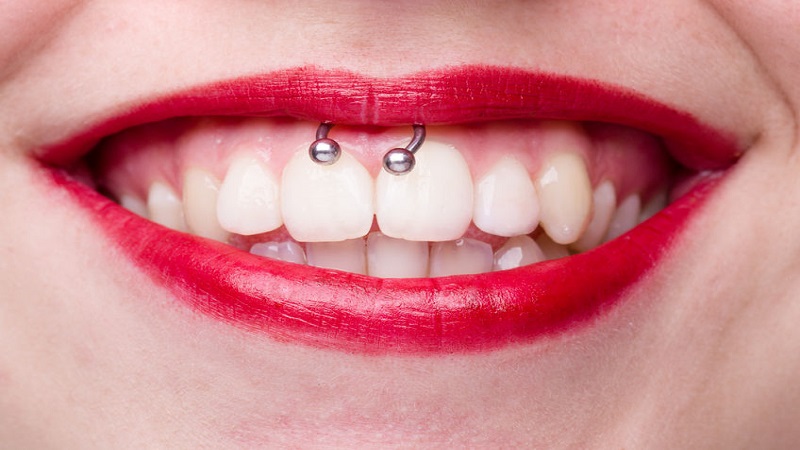 Smiley piercing: tutto quello che devi sapere Smiley piercing: tutto quello che devi sapere