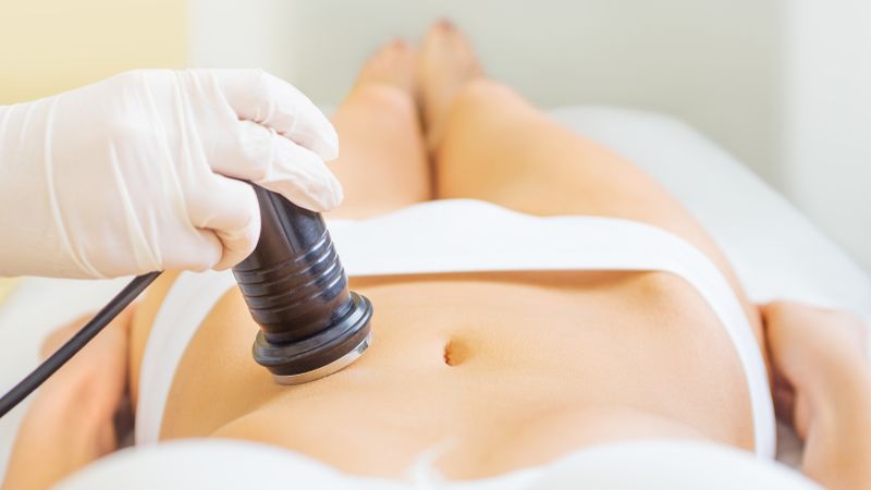 Cavitazione estetica Cavitazione estetica