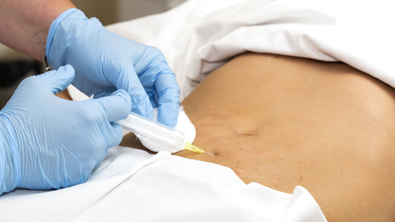 mesoterapia come si fa mesoterapia come si fa
