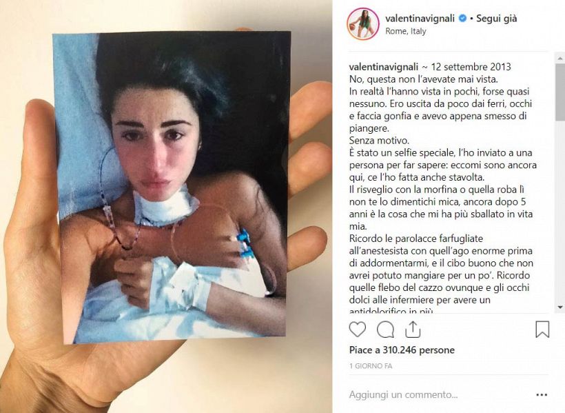 Valentina Vignali: "Così ho sconfitto il cancro"